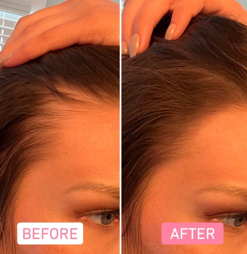 Root touch up for thinning hair