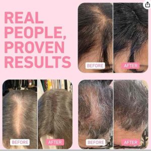 These hair fibers are 100% natural, dermatologically tested, and safe.