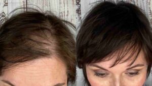 Hair toppers for short hair