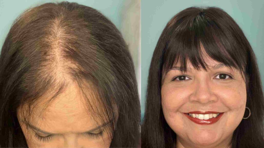 Human Hair Toppers with bangs