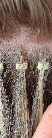 Micro-link/Loop Extensions: Also called micro bead or micro ring extensions