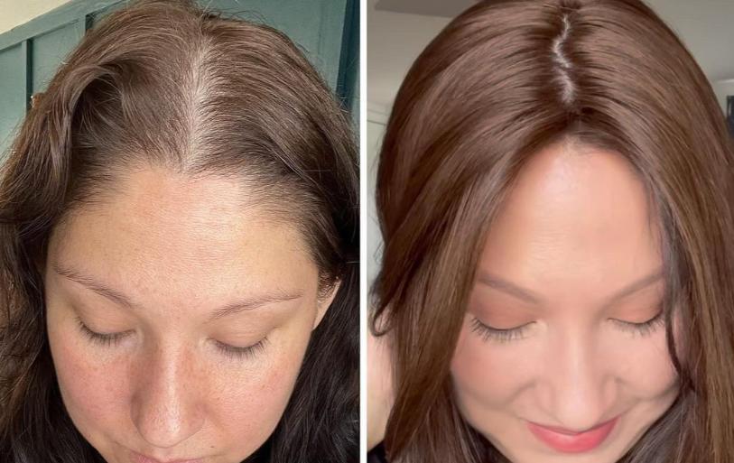 Hair toppers before and after